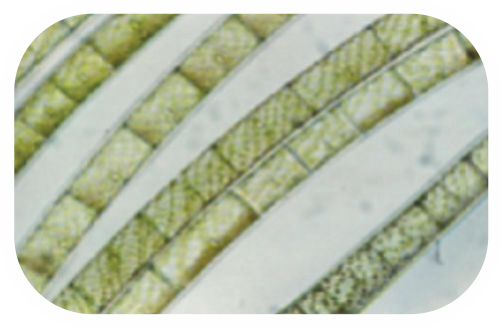 Spirogyra